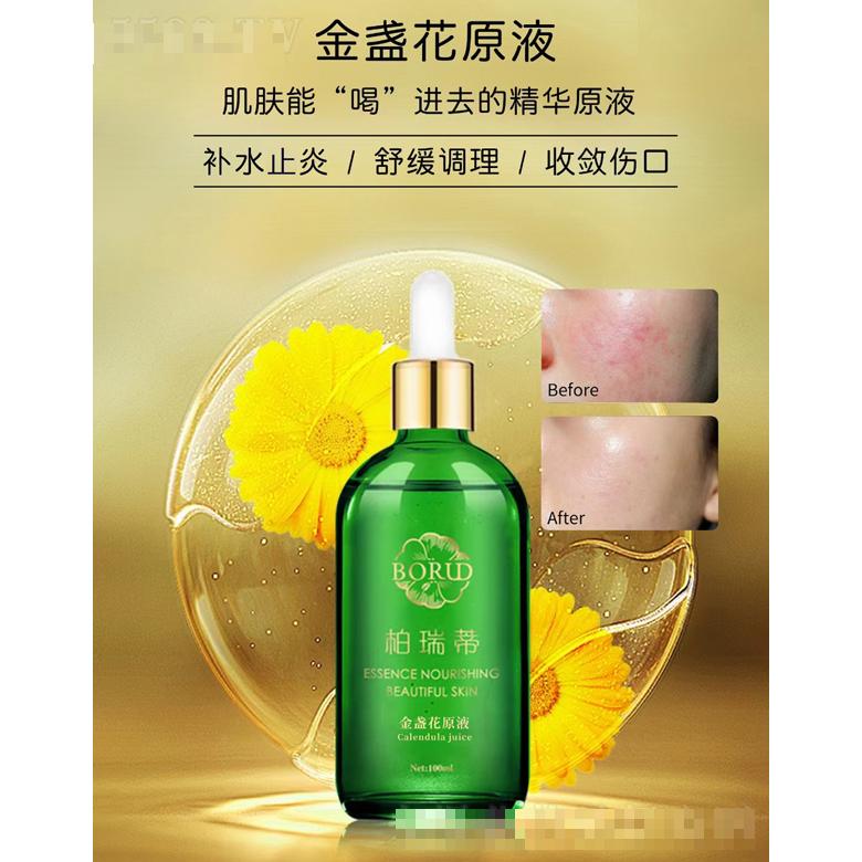 柏瑞蒂金盏花原液