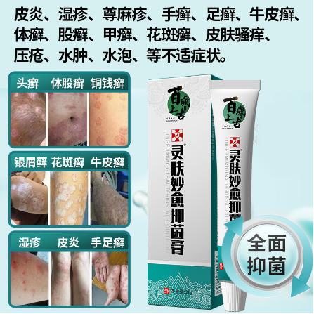手足牛皮藓护理止痒乳膏OEM代工